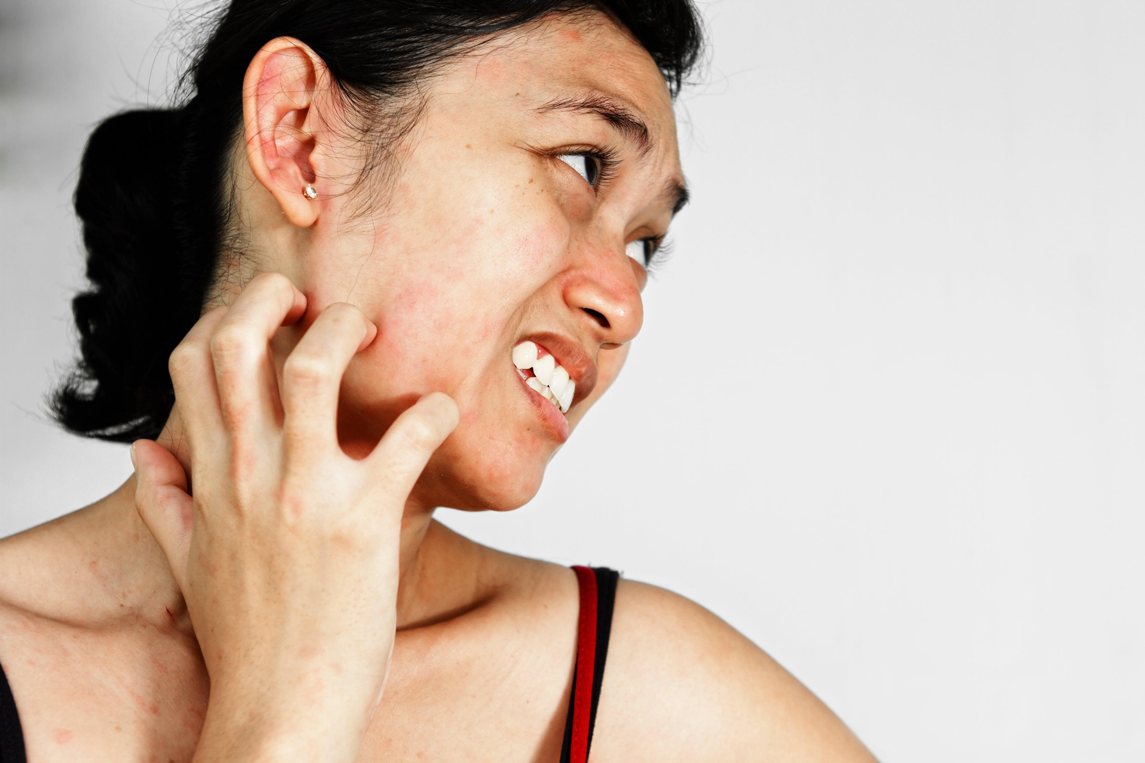 Comment calmer une démangeaison de la peau ? – Oleassence en Luberon