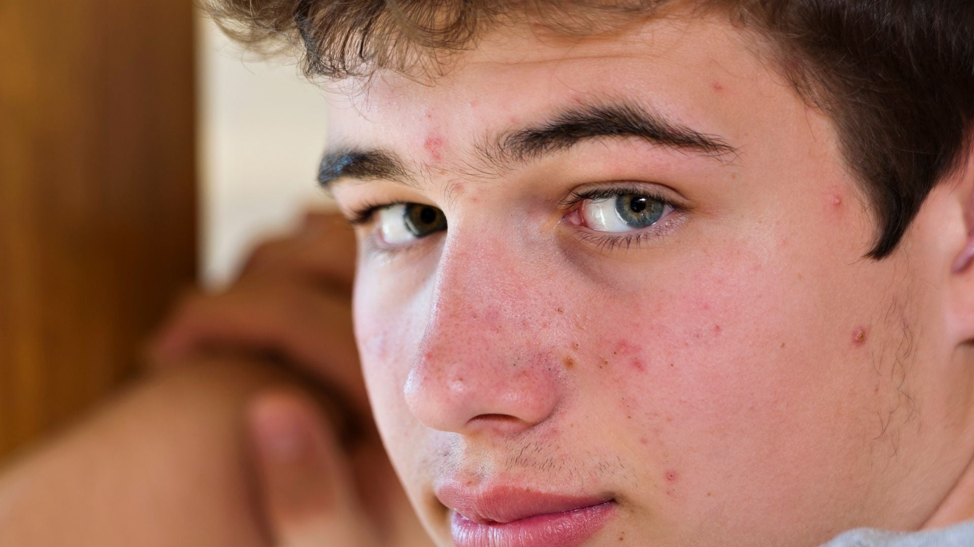 Soins naturels pour peaux jeunes