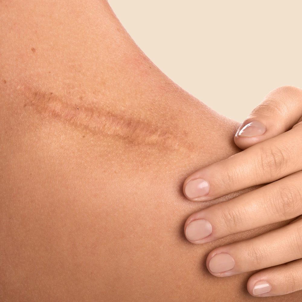 La réparation de la peau - Oleassence en Luberon