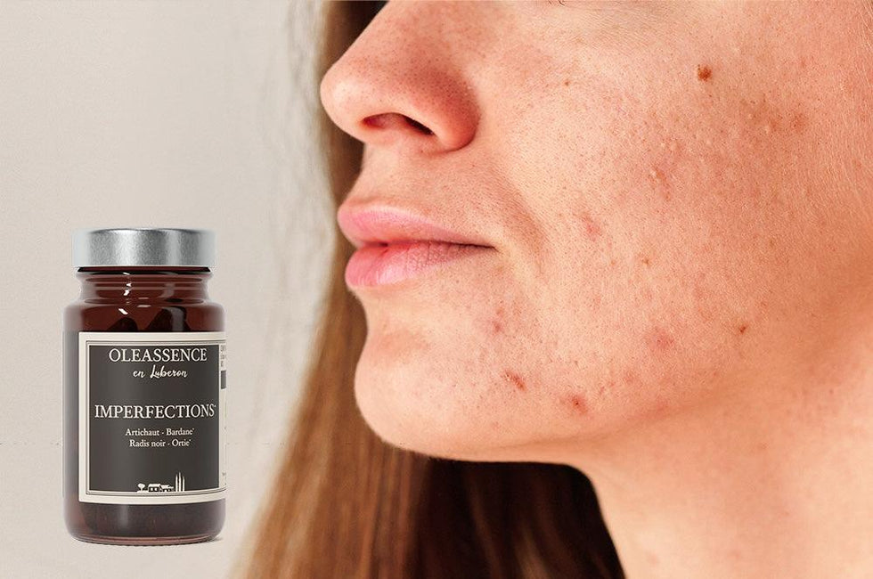 Peau à imperfections : le complément alimentaire naturel pour retrouver une peau nette
