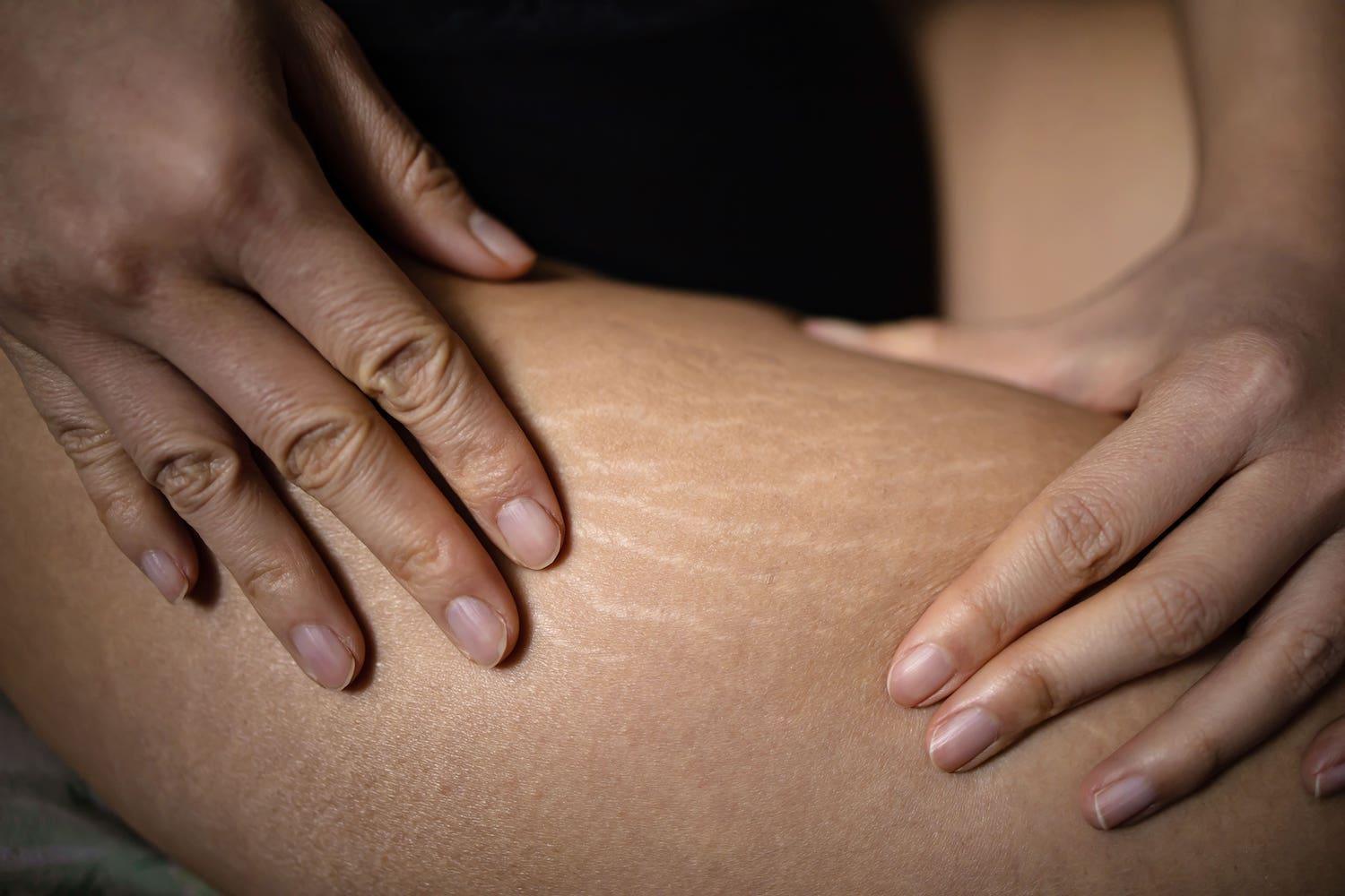 Vergetures - marques - Oleassence en Luberon