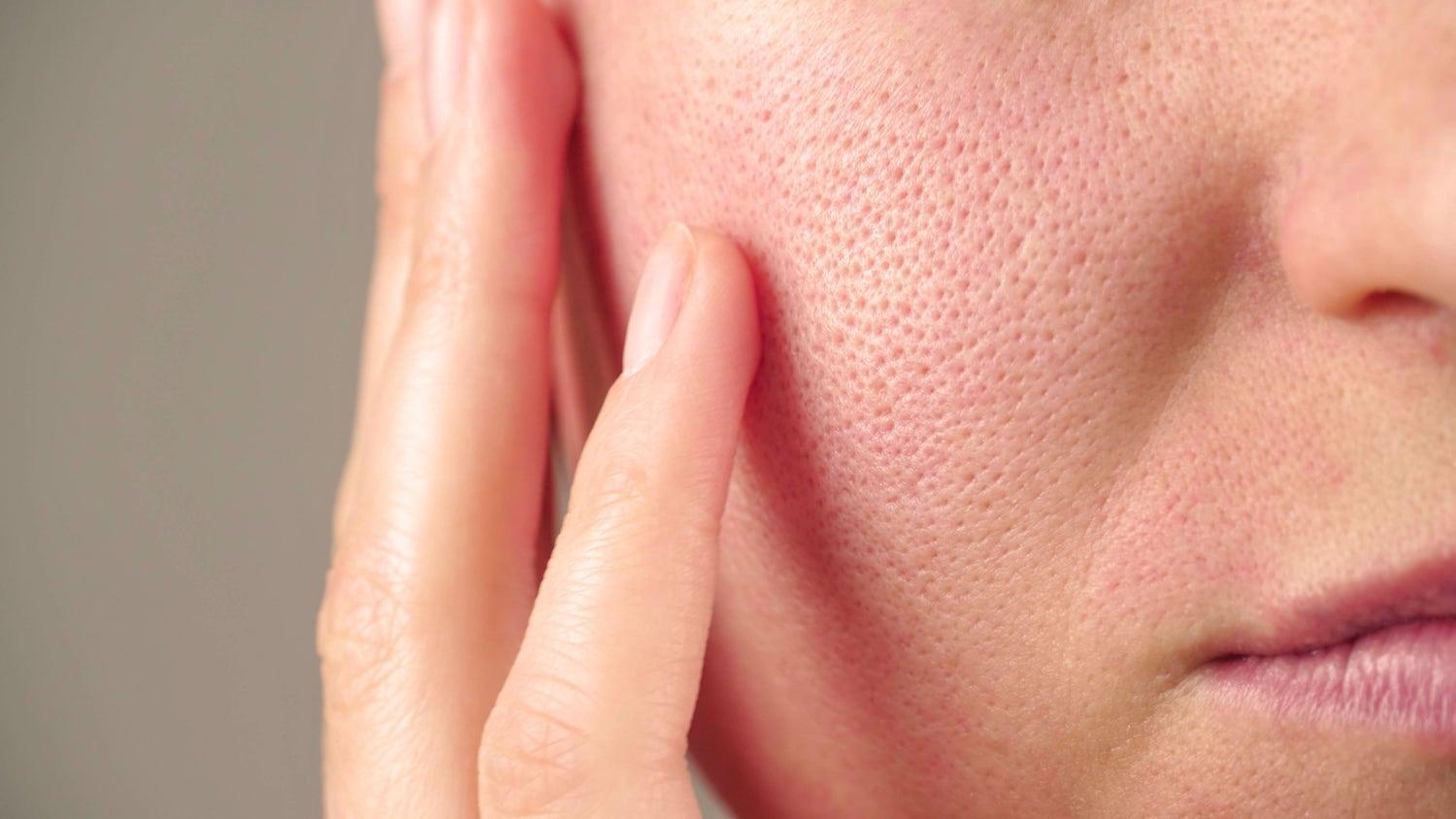 Texture naturelle d’une joue avec des pores visibles